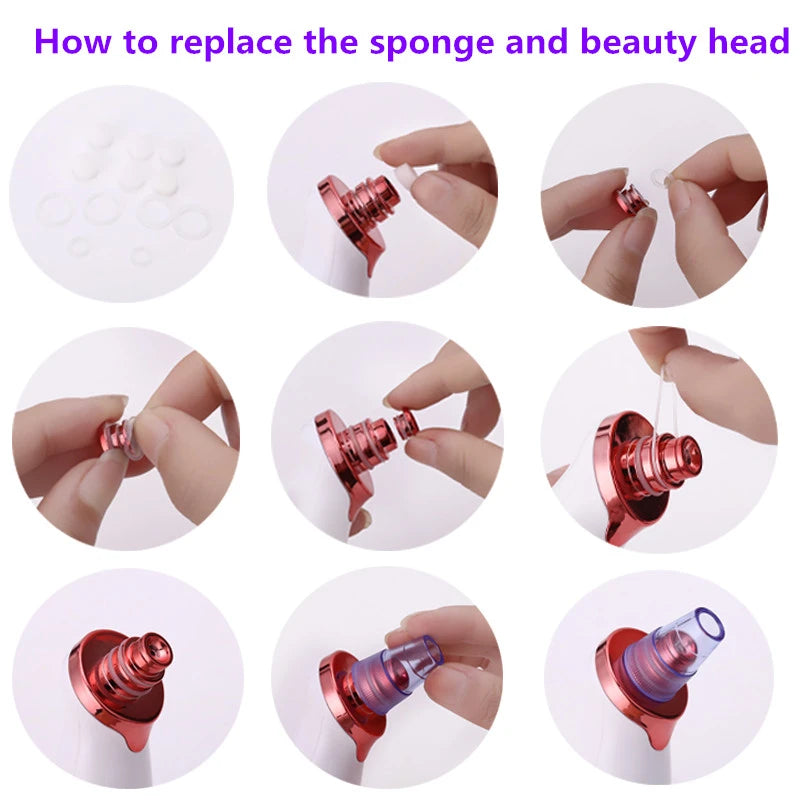 Facial Blackhead Remover